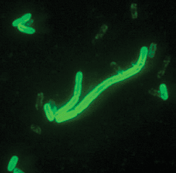 Imagen: Una coloración directa con un anticuerpo fluorescente de Yersinia pestis (Fotografía cortesía de Larry Stauffer).